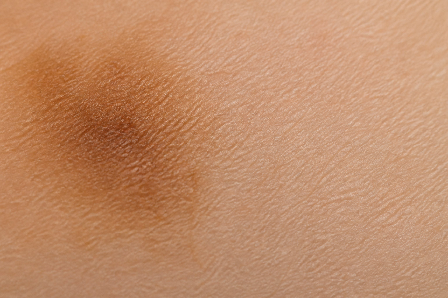 Comment effacer les taches et uniformiser ton teint durablement